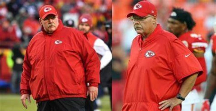 Andy Reid Weight Loss Surgery: Andy Reid Grappled With Being Overweight 