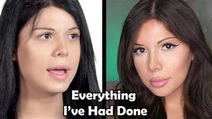 Blaire White Before and After Transformations Trans YouTuber Pl...