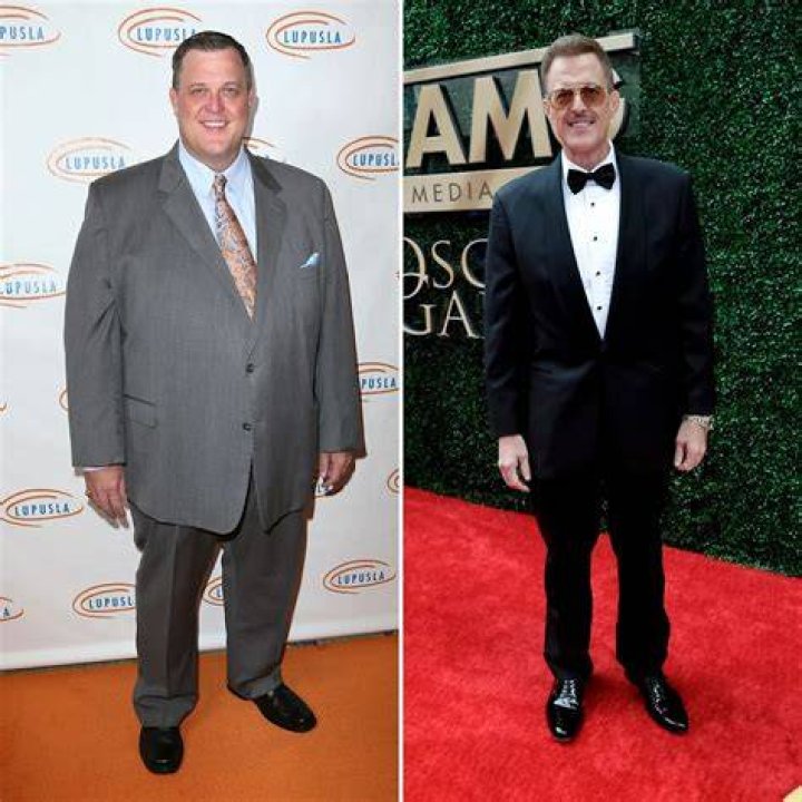 bob abishola weight loss surgery