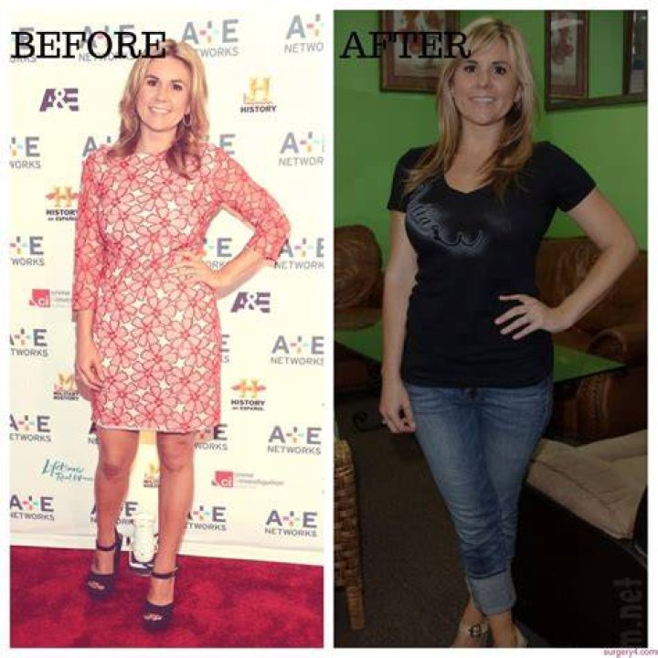 Brandi Passante Plastic Surgery Photos [Before & After] Surgery4
