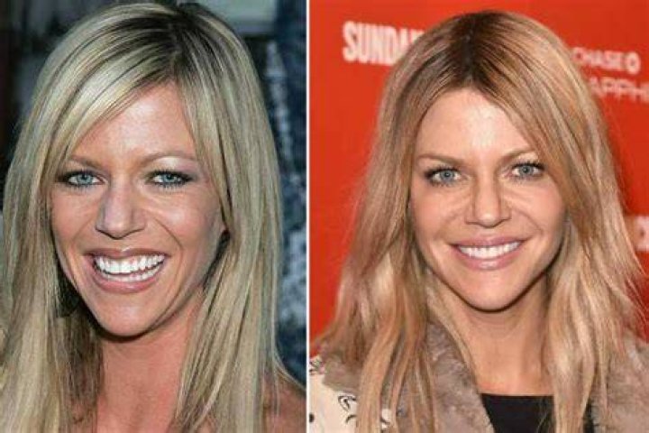 Did Kaitlin Olson Undergo Plastic Surgery Including Boob Job and Nose