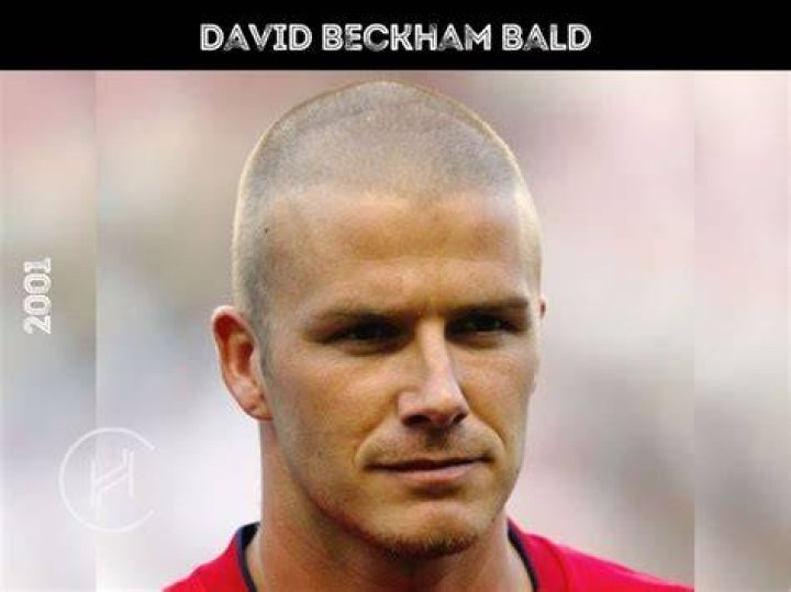 How a bald David Beckham might look with a cheeky hair flick