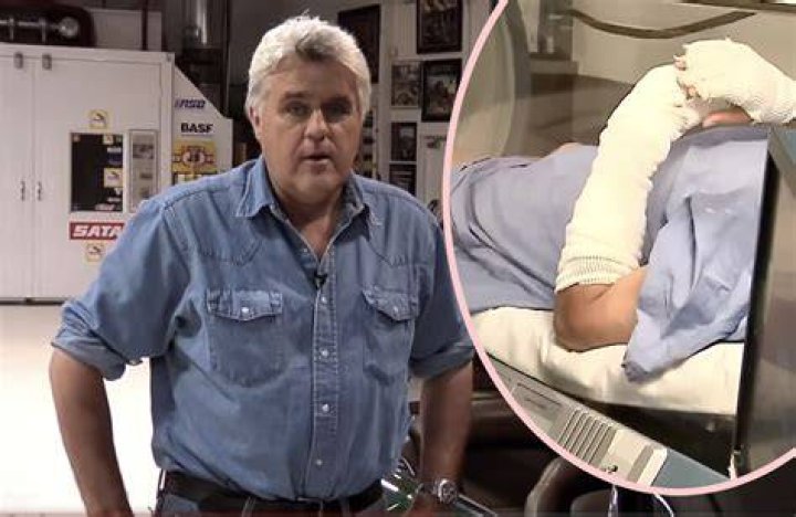 Jay Leno&rsquo;s Burns Seen for First Time as He&rsquo;s Released from Hospital IJR
