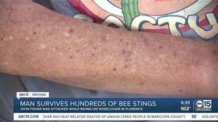 John Fischer was stung more than 250 times in the attack