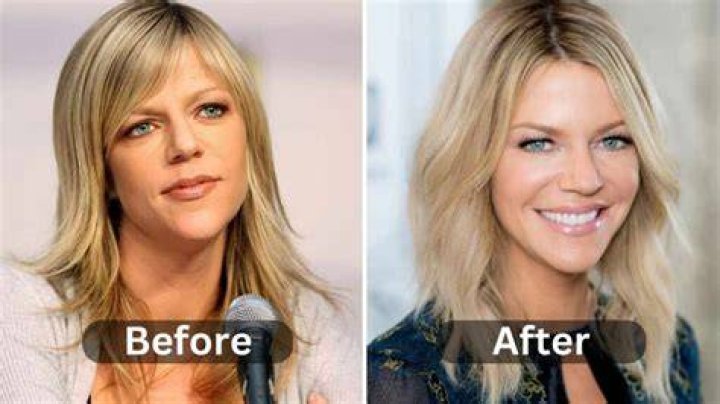 Kaitlin Olson Before And After modsihstory