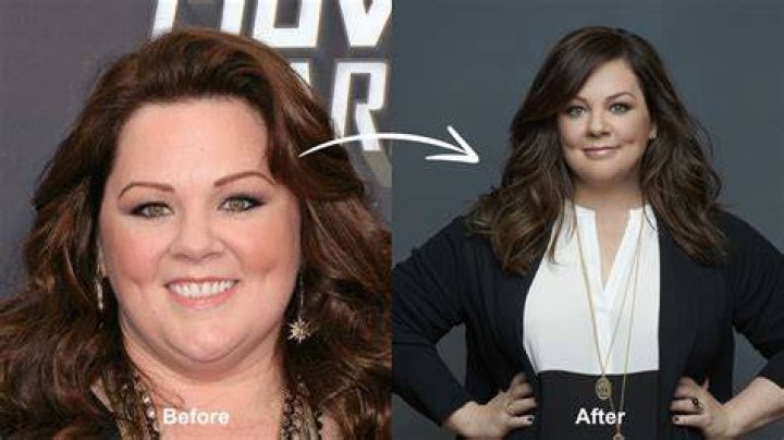 Melissa opted for surgery after taking advice from members of the public