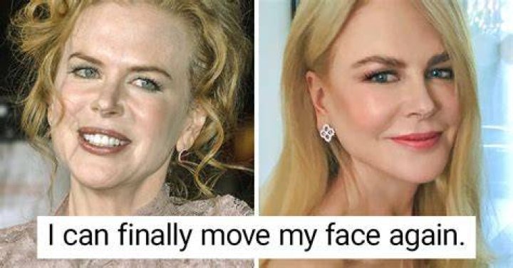 Nicole Kidman I tried Botox, but now I can move my face