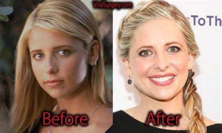  Sarah Michelle Gellar Plastic Surgery