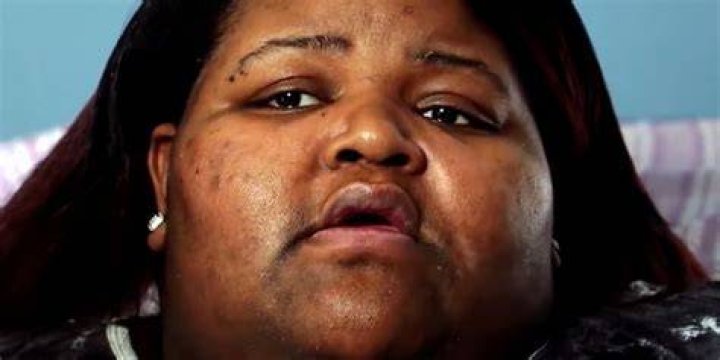 Schenee Murry Close-up of My 600-lb Life with a serious expression