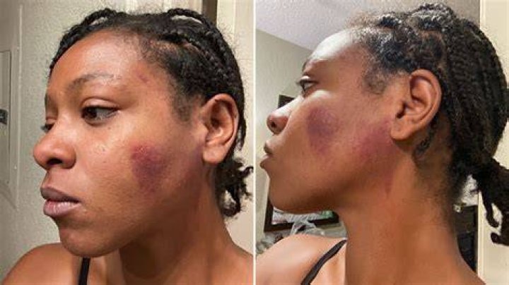 The young woman hit back at trolls on social media