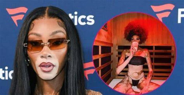  Winnie Harlow stripped down on Instagram as she prepared for the Met Gala